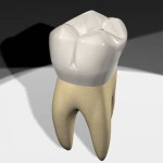 molar
