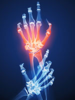 hand-joint-pain